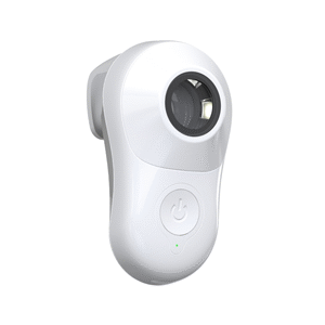 MoleScope II Dermatoscope Iphone 7+ Technology Skin Surface